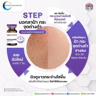 Neoclear Alpha arbutin 2% ultra clear spot serum เซรั่มลดฝ้ากระ จุดด่างดำ ผิวขาวใส