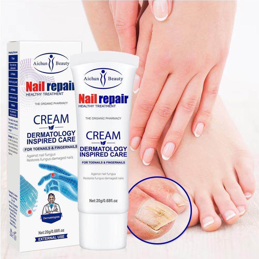 Aichun Beauty Nail Repair Cream – รับผลที่มองเห็นได้ ด้วยสัปดาห์