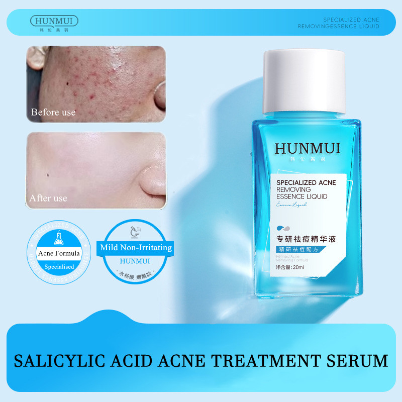 Hunmui Salicylic Acid ขวดสีฟ้าขนาดเล็กเซรั่มรักษาสิวลบสิวซ่อมแซมรอยสิว Lighten สิวรุนแรง 20ml