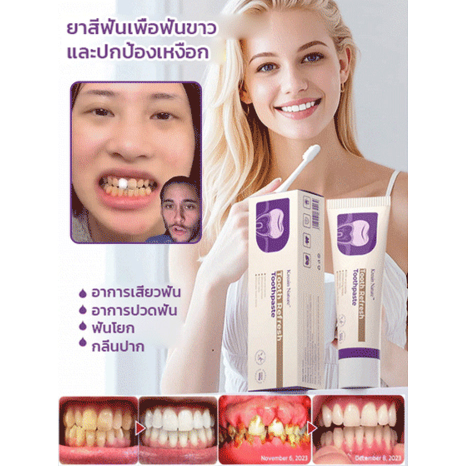 การรับรอง FDA🥇ซื้อ 1 แถม 2🥇ยาสีฟันสมุน ยาสีฟันไวท์เทนนิ่ง ยาสีฟันเบกกิ้งโซดา ซ่อมแซมฟัน ยาสีฟันฟันขาว ขจัดคราบเหลือง ปกป้องสุขภาพของเหงือก ยาสีฟัน ครีมดูแล สีขาวสว่างซ่อมแซมฟัน ข