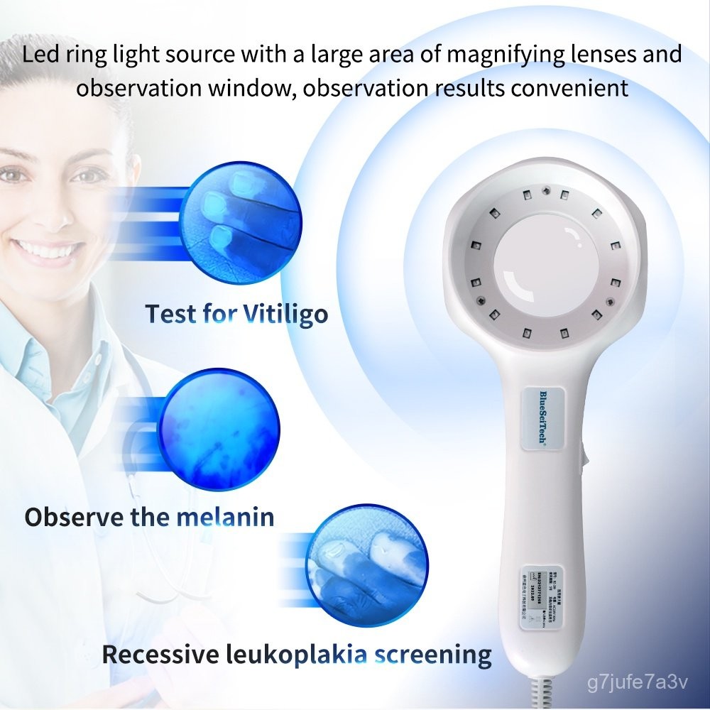 Woods' Lamp Light UV Light Cat Moss Detector Cat Fungus Detector UV Pet Sick Vitiligo Fungus Detecti