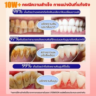 LYDIMOON ฟอกฟันขาว ขจัดคราบหินปูนสีเหลือง ยาสีฟันไวท์เทนนิ่ง 100g ให้ ฟันขาว ยาสีฟันสมุนไพร ช่วยลด หินปูน ฟันเหลือง