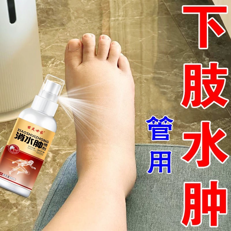 ลด Edema ลบ Lower Limbs Edema ลอย Enema เท้า Enema ผู้สูงอายุผู้หญิงอยู่ประจํายาวยืนขาเท้า Edema Fal