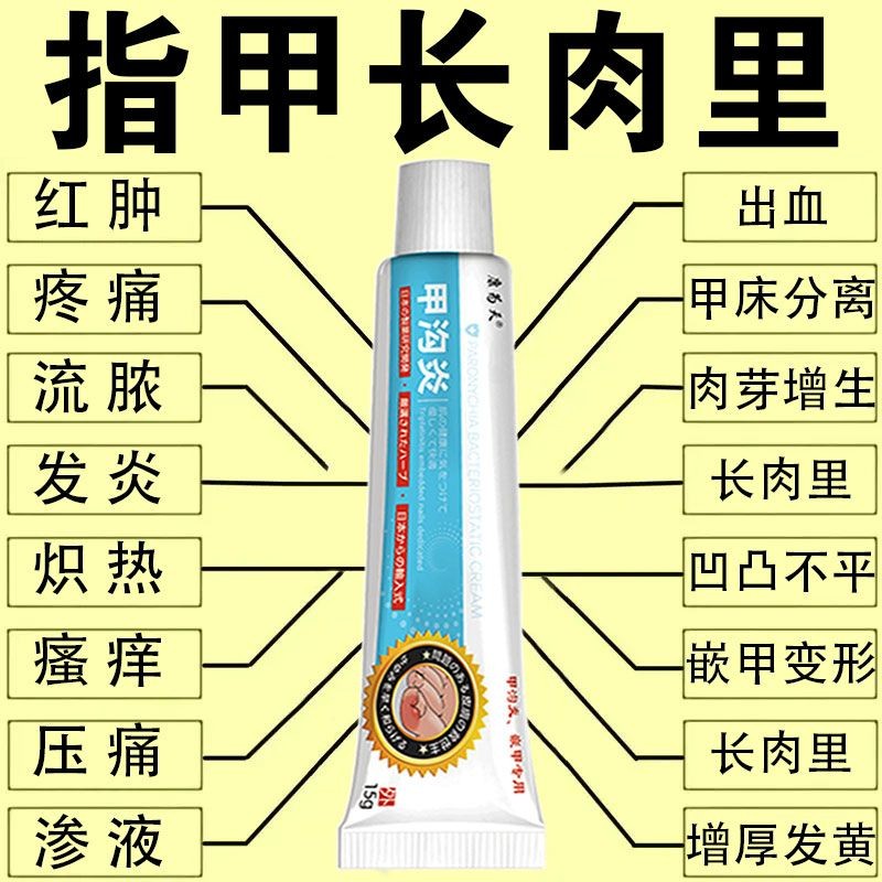 7430 คน สรรเสริญ แลคโตเรียพิเศษสําหรับเล็บอักเสบครีมต้านเชื้อแบคทีเรียพิเศษสําหรับ n7430膏人好 全身加厚加绒服大