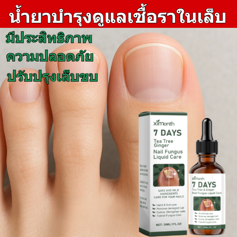 โซลูชั่นดูแลเล็บหนาขึ้นเพื่อปรับปรุงเล็บสีเทาและเล็บนุ่ม การดูแล โซลูชั่นบํารุง โซลูชั่นสดใส