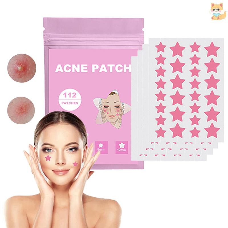 [VI] 112 ชิ้น/เซ็ต Pimple Patch สิวที่มีสีสันที่มองไม่เห็น Skin Care สติกเกอร์คอนซีลเลอร์ Face Spot 