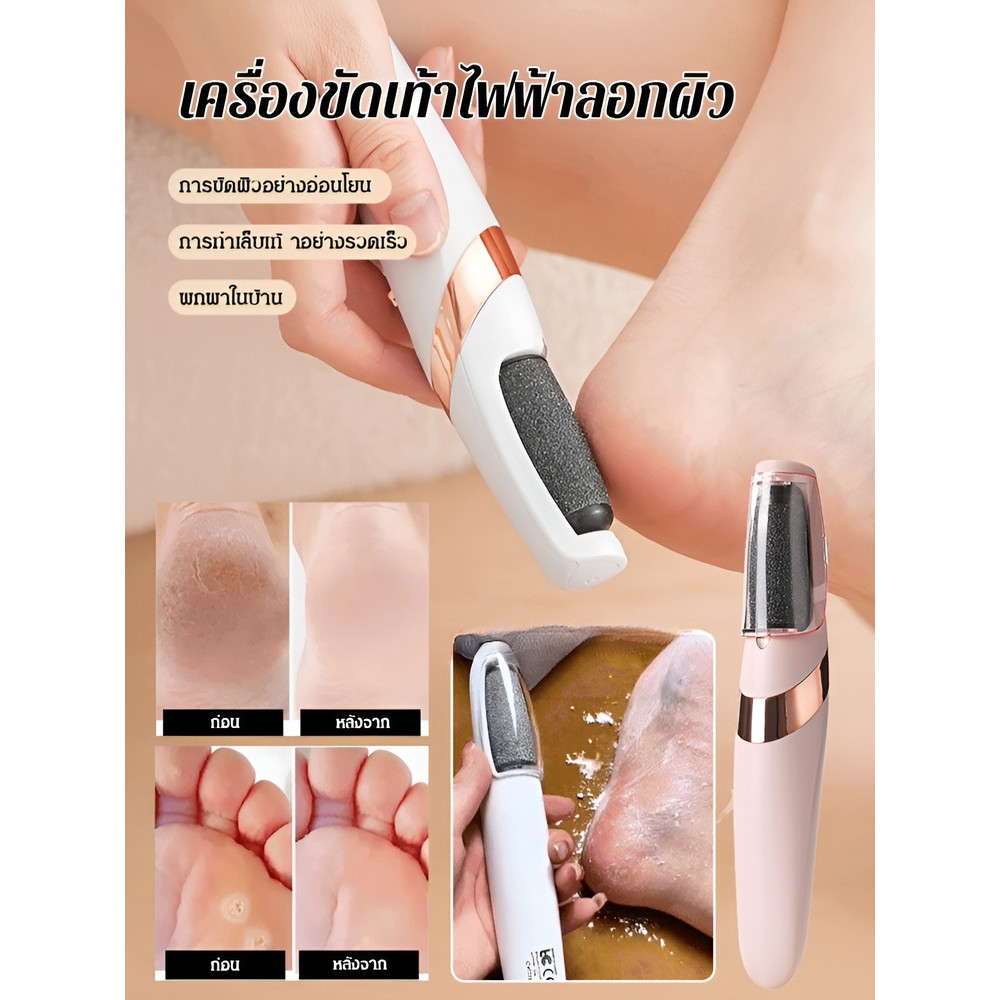 🔥สินค้าขายดี🔥เครื่องขัดส้นเท้าแตก/เครื่องขัดผิวไฟฟ้ากันน้ำเพื่อขจัดหนังด้านและเคราตินอย่างอ่อนโยน