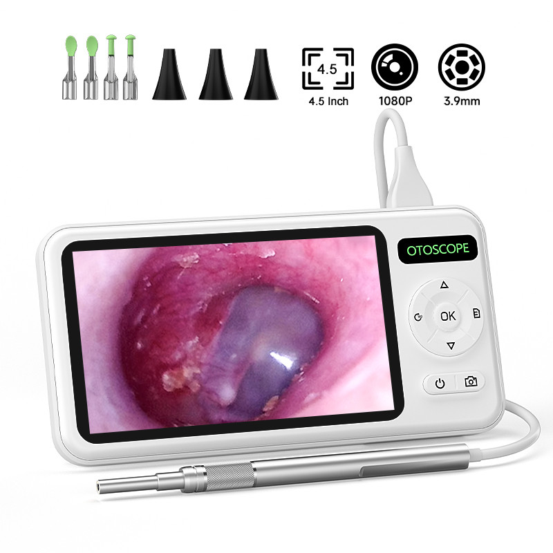 4.5 นิ้ว Digital Otoscope HD1080P 3.9 มม.Ear Picker กล้อง 6 LEDs เครื่องมือกําจัดขี้หูทําความสะอาดหู Stick สําหรับเด็กผู้ใหญ่