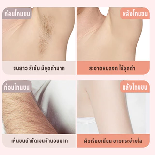 เครื่องกำจัดขนไฟฟ้า เครื่องโกนขนสองหัว ไม่ทำร้ายผิว เครื่องโกนขนไฟฟ้า กำจัดขนแร้ ขนบิกินีไลน์ 2in1 เครื่องกำจัดขนสตรี