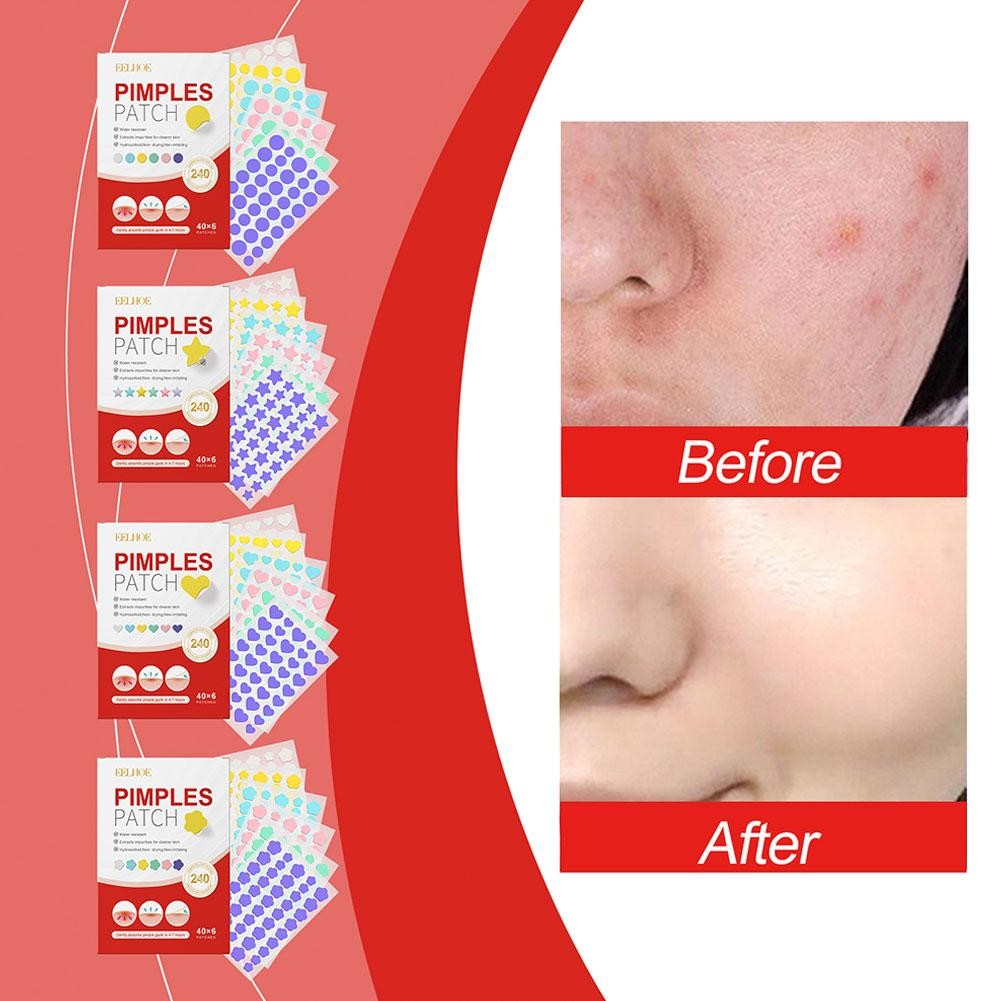 240pcs Salicylic Acid Acne PatchStar Pimple Patch คอนซีลเลอร์ Skin Spot Acne Care สีสัน D8R9