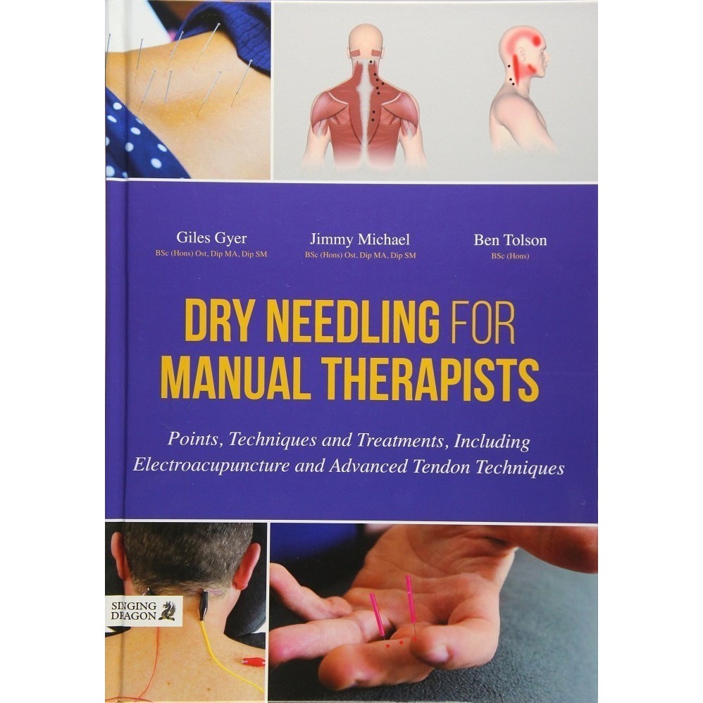 Dry Needling for Manual Therapist: Points, Techniques and Treatments A