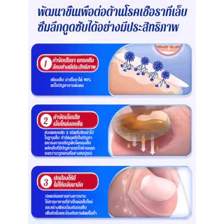 ✨ฆ่าเชื้อราได้ผลใน 7 วัน⏱️น้ำยารักษาเชื้อราที่เล็บ น้ำยาซ่อมแซมเล็บเหลือง น้ำยารักษาเล็บ กำจัดเสีย ซ่อมแซมแตก ฟื้นฟูเนื้อใหม่แบบเห็นผลชัดเจน