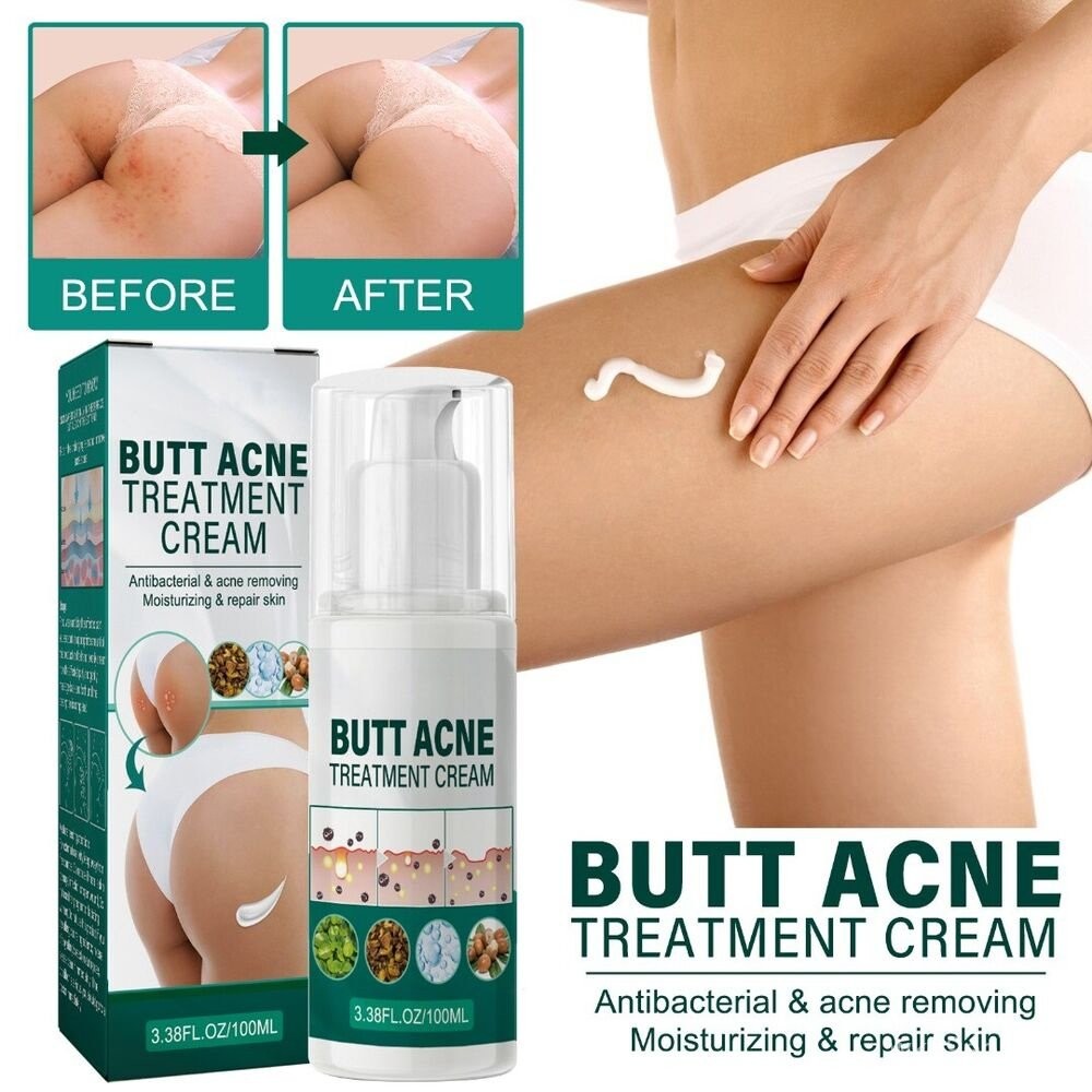 LOVKOR 100ml Butt Pimple Clearing Treatment, Butt Acne Clearing Lotion, Balance Oil Moisturising Ski