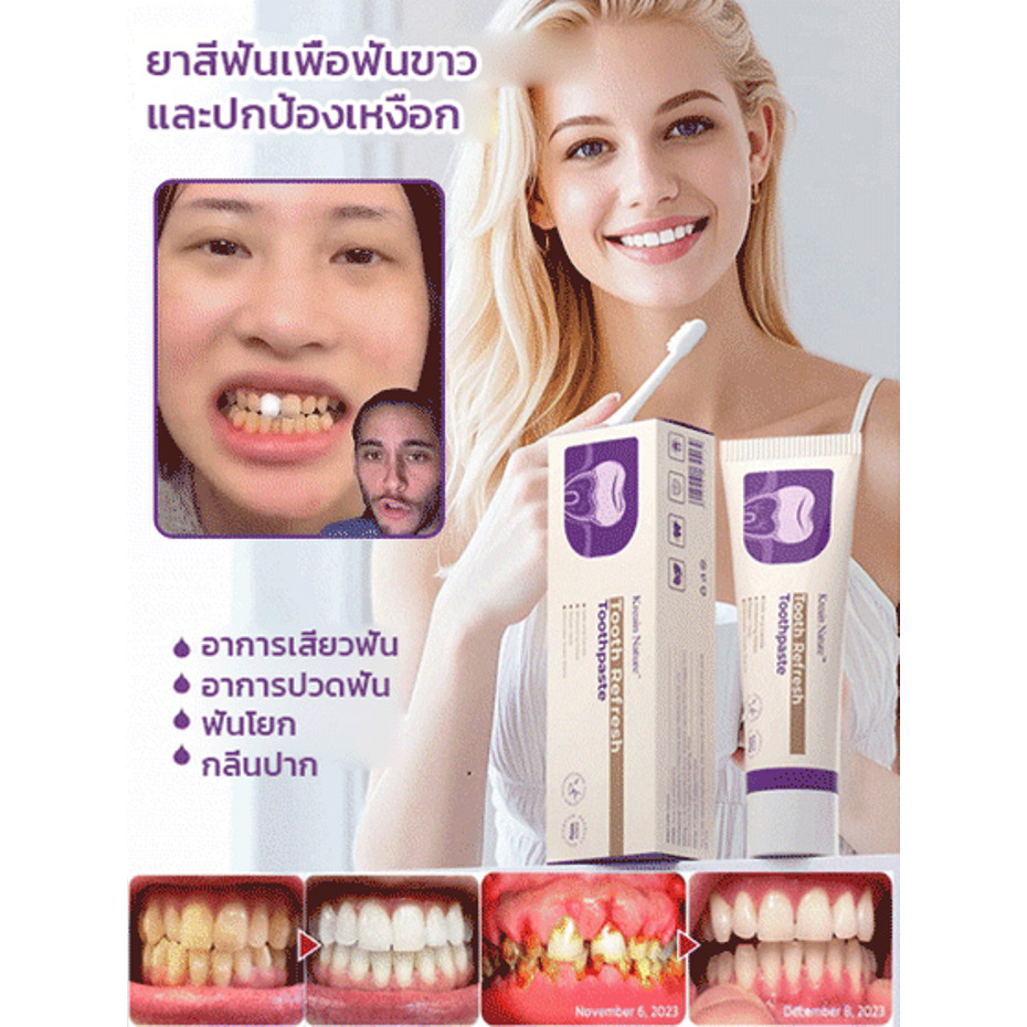 🥇ซื้อ 1 แถม 1🥇ยาสีฟันไวท์เทนนิ่ง ยาสีฟันเบกกิ้งโซดา ซ่อมแซมฟัน ยาสีฟันฟันขาว ขจัดคราบเหลือง ปากสะอาด ยาสีฟันสมุนไพร