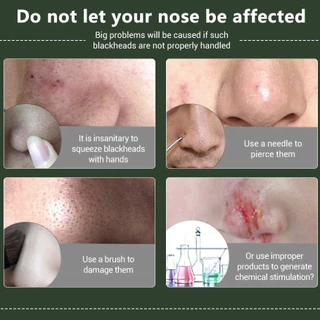 LANBENA Blackhead Remover Mask 50g แผ่นมาส์กกำจัดสิวเสี้ยน ลดสิวเสี้ยน ทำความสะอาดรูขุมขน มาส์กหน้า