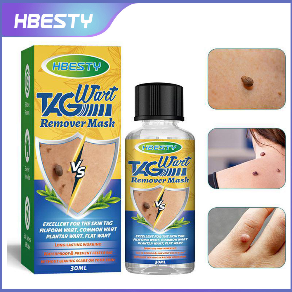 HBESTY Gram Wart Liquid Hand Foot Euro Corn Herbal Essence Care Wart Liquid 3pfxiaohua