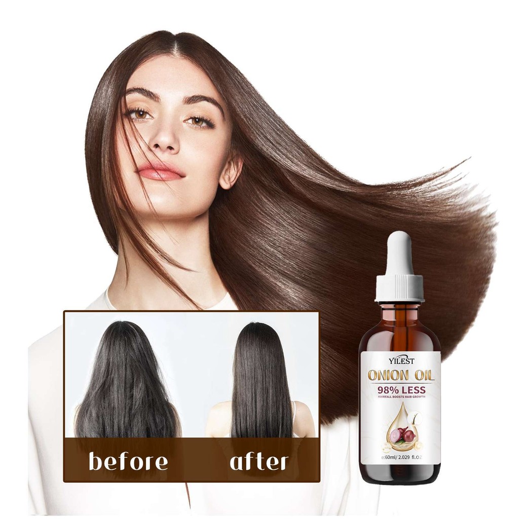 YILEST Onion Hair Care Essential Oil Onion Scalp Cleanser Moisturizing Hair Smooth Glossy Hair Care 