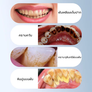 Aoduoyaya ที่ขูดหินปูนไฟฟ้า เครื่องขูดหินปูนไฟฟ้า 2ใน1 เครื่องขัดฟัน ขจัดคราบผิวฟัน การฟอกสีฟัน