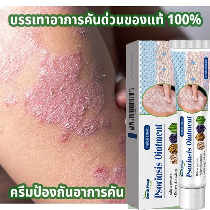 SOUTH MOON แพ้ยุง สะเก็ดเงิน กลากเกลื้อน ผื่นคัน อ่อนโยน เพิ่มความชุ่มชื้น ผิวหนังอักเสบ ครีมทำความสะอาดผิวกายปกป้องผิว