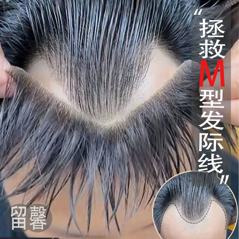 Hair Line Wig Sticker Mens m-Xiaowangs Grocery Store