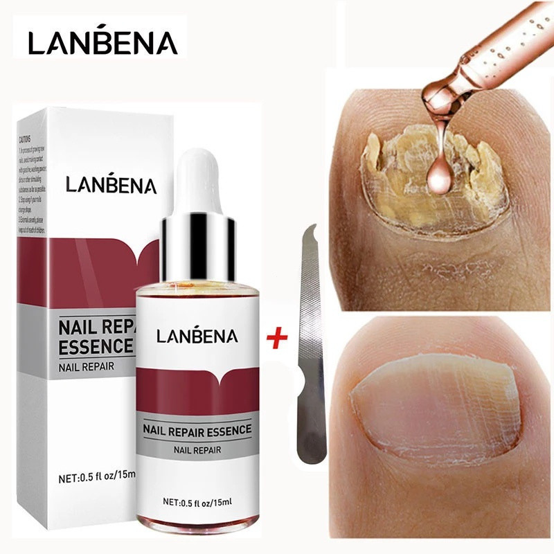 LANBENA Original Nail Repair Essence Serum Fungal Nail Treatment