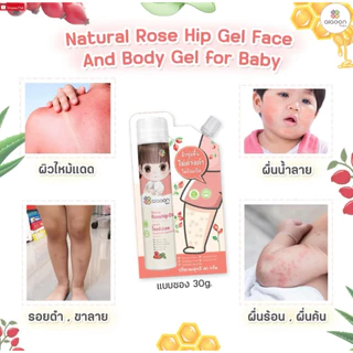 (ส่งด่วน⚡️ไม่มีวันหยุด) ไออุ่น โรสฮิปเจล บำรุงผิว ลดรอยดำ (AiaoonRosehip Gel for Face and Body) บำรุงผิวหน้าผิวกายเด็ก