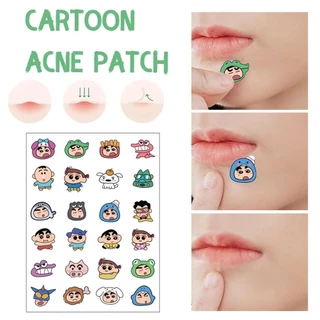 24 ชิ้น/แผ่น Crayon Shinchan แผ่นแปะสิวการ์ตูน PE แพทช์ระบายอากาศสิว G8C3