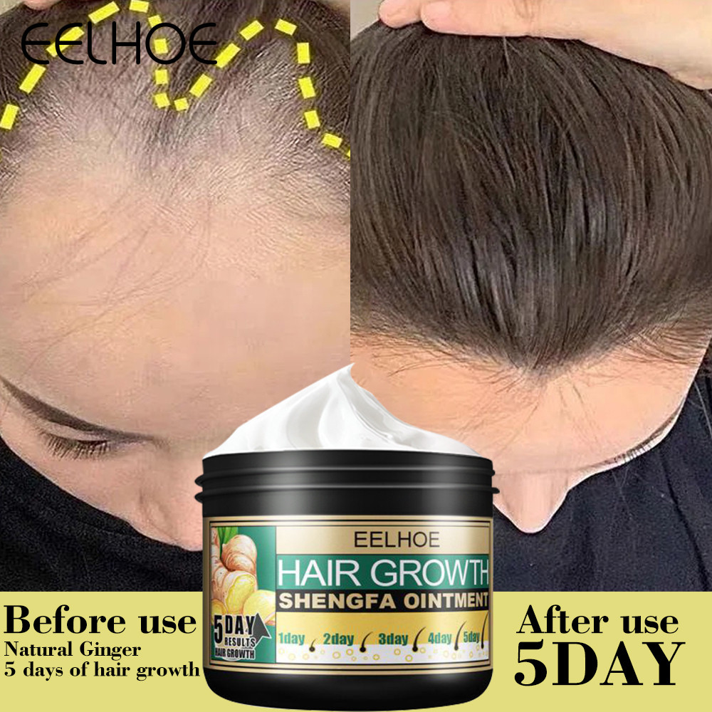 30g Ginger Hair Growth Care Ointment Hair Rapid Regeneration Hair Loss บํารุงน้ํายาปรับผ้านุ่มหนังศี