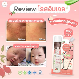 (ส่งด่วน⚡️ไม่มีวันหยุด) ไออุ่น โรสฮิปเจล บำรุงผิว ลดรอยดำ (AiaoonRosehip Gel for Face and Body) บำรุงผิวหน้าผิวกายเด็ก