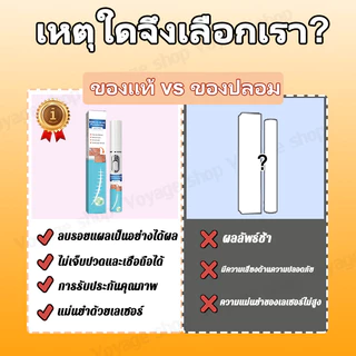 การกำจัดรอยแผลเป็นด้วยเลเซอร์, ลดรอยแผลเป็น, การกําจัดรอยแผลจากสิว, ลดแตกลาย, ลดเลเซอร์, รักษาเป็น, การกําจัดผ่าตัด