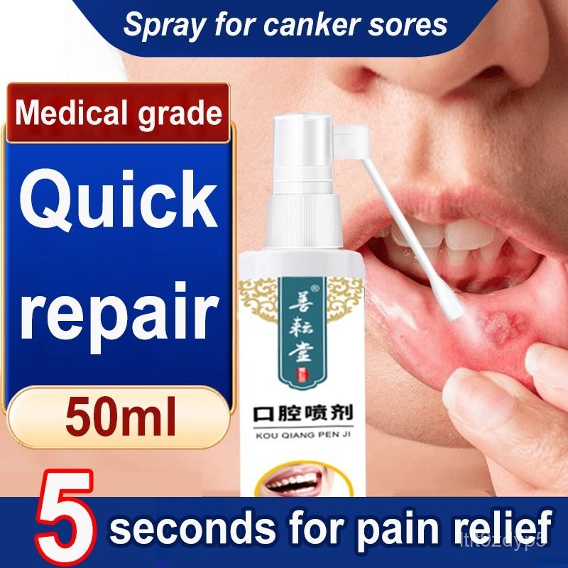 50ML Oral Ulcer Sprays Canker Sore Sprays Treatment Pharyngitis Halitosis Sore Antibac Mouth Ulcers
