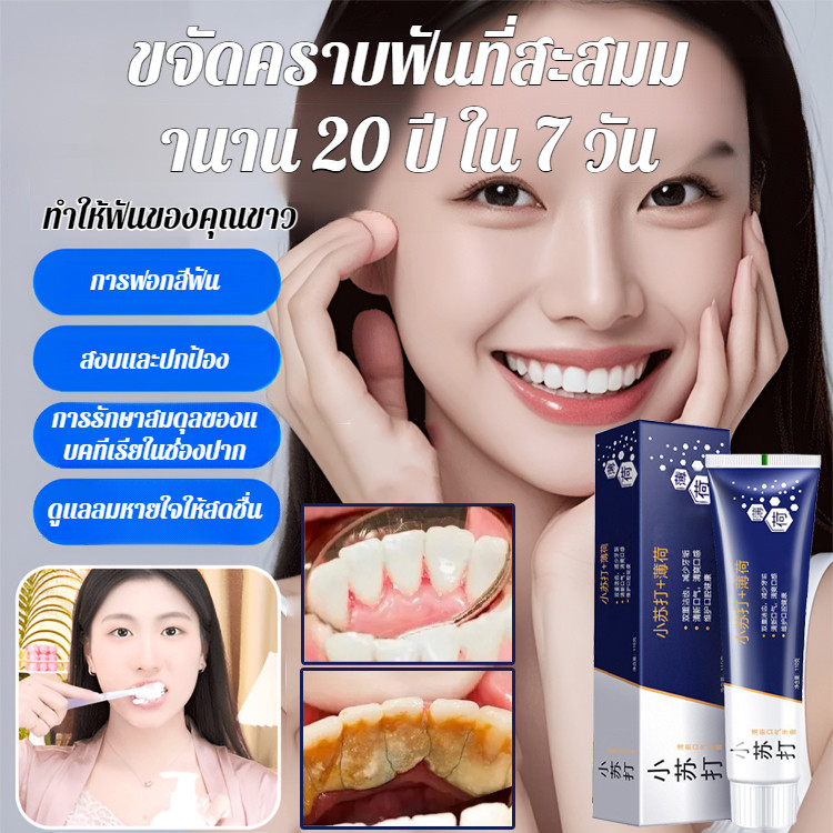 ยาสีฟันเบกกิ้งโซดา ดูแลช่องปาก ขจัดคราบหินปูน ทําความสะอาดฟัน มิ้นท์ เหมาะสําหรับทั้งชายและหญิง