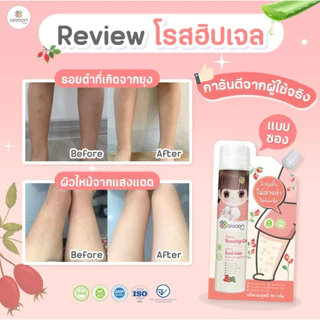 (ส่งด่วน⚡️ไม่มีวันหยุด) ไออุ่น โรสฮิปเจล บำรุงผิว ลดรอยดำ (AiaoonRosehip Gel for Face and Body) บำรุงผิวหน้าผิวกายเด็ก