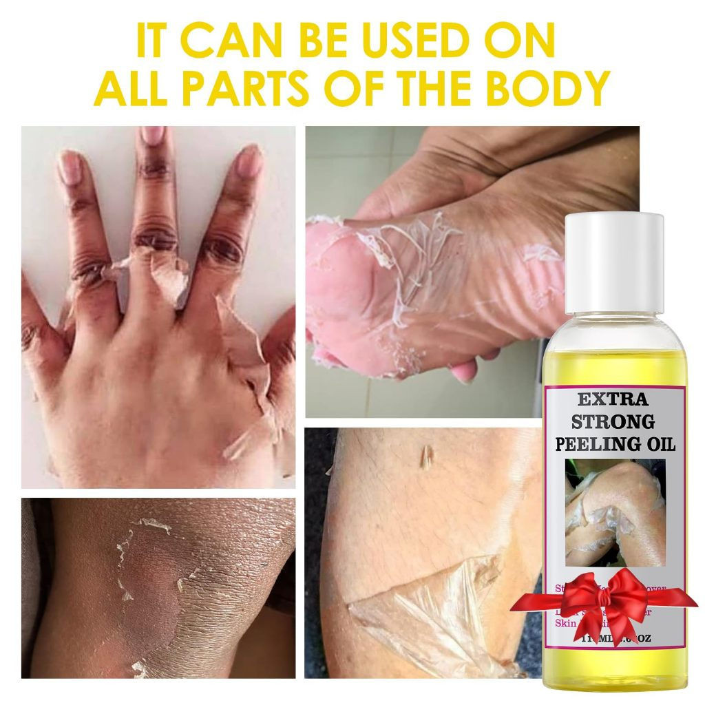 จัดส่งรวดเร็วMOOYAM Peeling Oil for Dark Skin, Yellow Peeling Oil, Strong Peeling Oil Extra Strength
