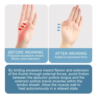 SRIEI 1PCS ผู้ถือนิ้วมือ Protector Brace กีฬาทางการแพทย์ข้อมือ Thumbs Splint สนับสนุน Breathable ป้องกันเกียร์ซ้าย/ขวามือ