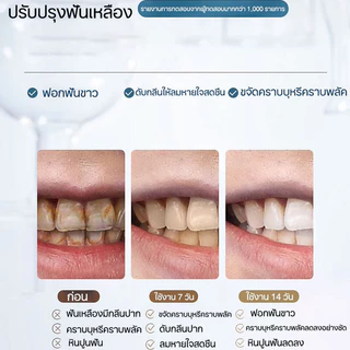 LYDIMOON ฟอกฟันขาว ขจัดคราบหินปูนสีเหลือง ยาสีฟันไวท์เทนนิ่ง 100g ให้ ฟันขาว ยาสีฟันสมุนไพร ช่วยลด หินปูน ฟันเหลือง