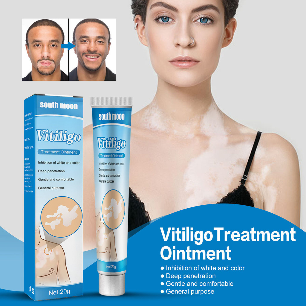 ครีมทาผิว South Moon Tinea Care Health Ointment ครีมล้างจุดขาว Tinea Versicolor Vitiligo ครีมใช้ภายนอก 3pfjintian.my