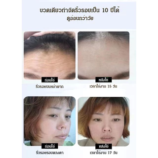 🎁ซื้อ 1 แถม 1【✨เห็นผล30วัน ยกกระชับ3D】ให้ความชุ่มชื้น24ชม/ลดริ้วรอยตีนกา-คอ/ครีมลดริ้วรอยและยกกระชับผิวด้วยโปรตีนจากไข่