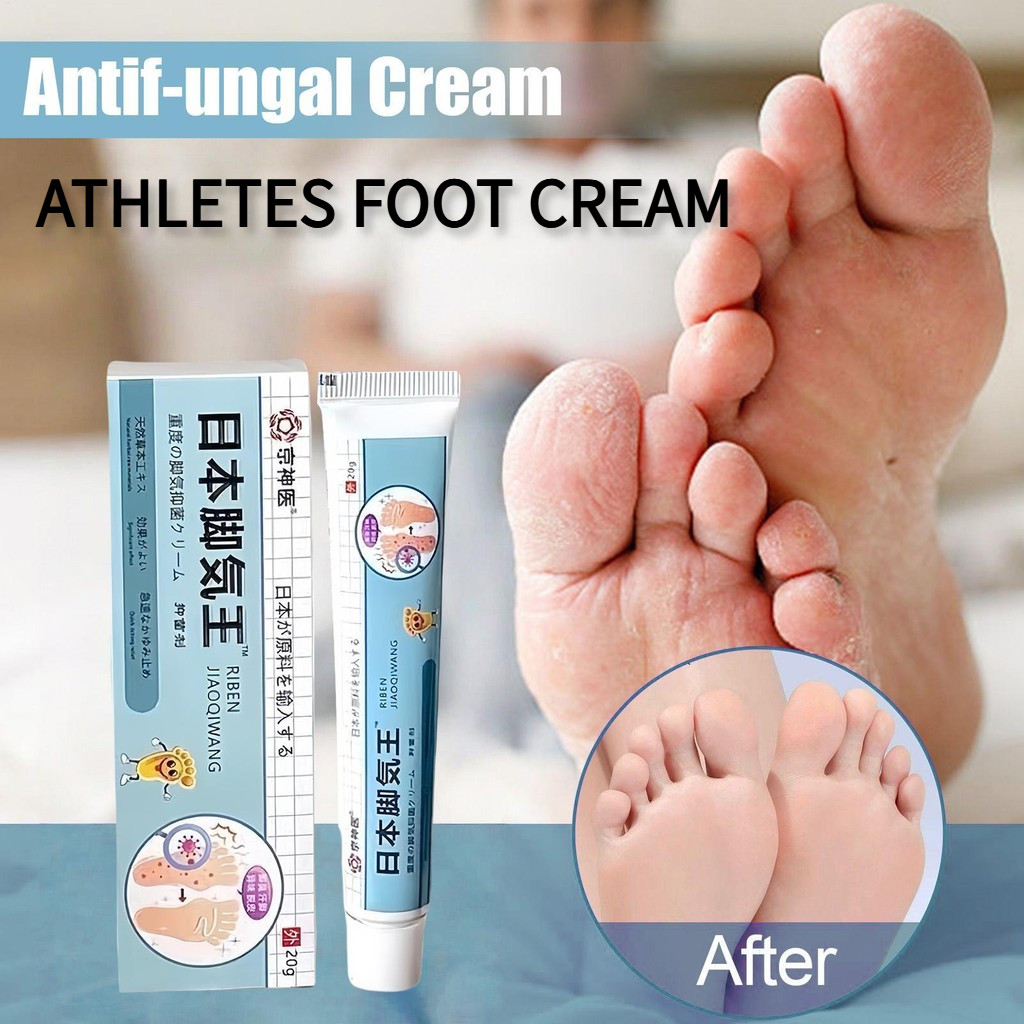 Antif-ungal ครีม 20g บรรเทาอาการคัน Jock Itch ครีม Quick Absorbing ซ่อมฟุตโลชั่นบรรเทาอาการคันเล็บ C