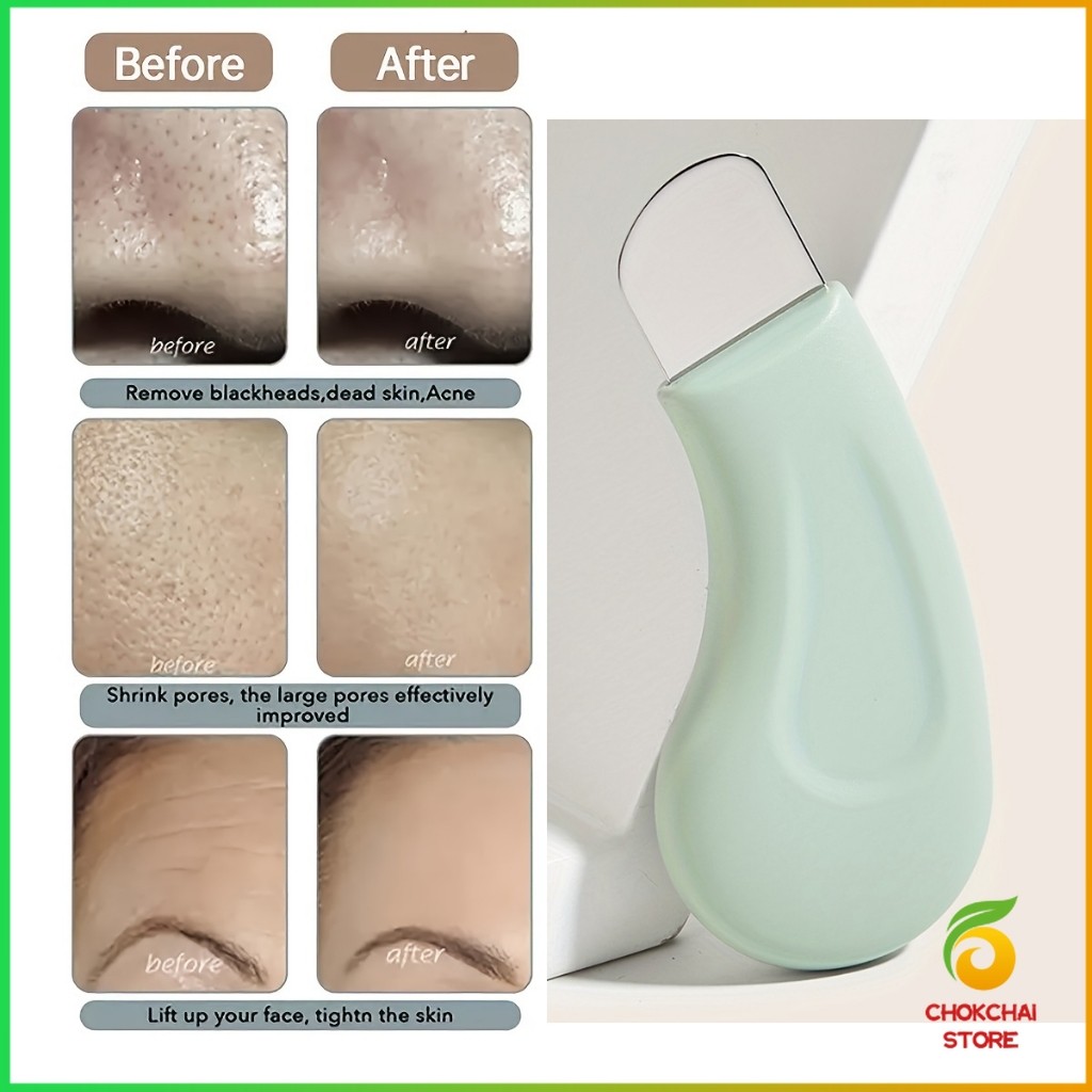 กําจัดสิวหัวดํา Dead Skin Acne Silicone Scraper Facial Hair Follicle Cleaner เป็นเครื่องมือเสริมความงามสําหรับร้านเสริมส