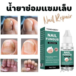 ( TO-01 เขียว 10ml ) ฆ่าเชื้อราที่เล็บ TONISABERY ซรั่มรักษาเล็บ ซ่อมเล็บที่ชำรุด เชื้อราเล็บ ครีมบำรุงเล็บ น้ำยารักษ...