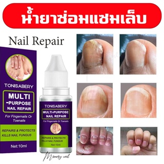 ( TO-03 ม่วง 10ml ) ฆ่าเชื้อราที่เล็บ เซรั่มบำรุงเล็บ ยาเชื้อราเล็บ ซรั่มรักษาเล็บ เชื้อราเล็บ ครีมบำรุงเล็บ ฆ่าเชื้อ...