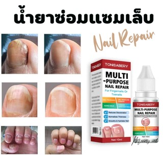 ( TO-02 แดง 10ml ) ฆ่าเชื้อราที่เล็บ TONISABERY ซรั่มรักษาเล็บ ซ่อมเล็บที่ชำรุด เชื้อราเล็บ ครีมบำรุงเล็บ น้ำยารักษาเ...