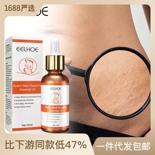 Hot Sale# EELHOE stretch repair and fading essential oil pregnant womens tensioning and relaxation pregnancy skin care essence 8cc