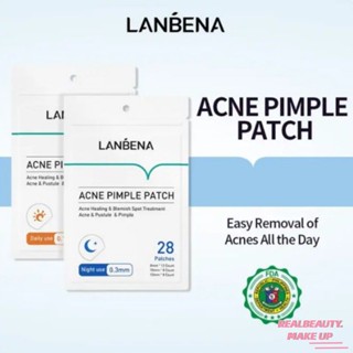 【2PCS SET】LANBENA Pimple Patch Acne Remover Pimple Marks Acne Treatment Day and Night Use Set [realbeauty]