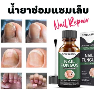 ( TO-04 เขียวใหญ่ 30ml ) ฆ่าเชื้อราที่เล็บ TONISABERY ซรั่มรักษาเล็บ ซ่อมเล็บที่ชำรุด เชื้อราเล็บ ครีมบำรุงเล็บ น้ำยา...