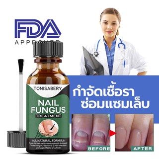 ( TO-04 เขียวใหญ่ 30ml ) รักษาเชื้อราเล็บ ยาทาเชื้อราเล็บ เชื้อราที่เล็บ รักษาเล็บ เชื้อราที่เล็บ รักษาเล็บขบ ฆ่าเชื้...