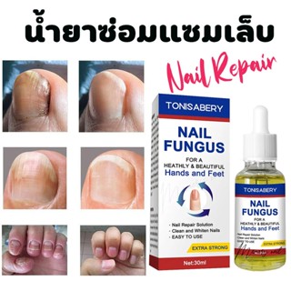 ( TO-05 ขาวใหญ่ 30ml ) ฆ่าเชื้อราที่เล็บ TONISABERY ซรั่มรักษาเล็บ ซ่อมเล็บที่ชำรุด เชื้อราเล็บ ครีมบำรุงเล็บ น้ำยารั...