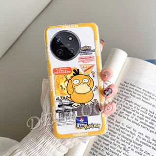 เคสโทรศัพท์มือถือ TPU แบบนิ่ม ลายการ์ตูนเป็ดสีเหลือง สําหรับ Realme 11 NFC C51 4G Realme11 11NFC RealmeC51 2023