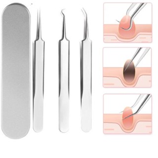 แหนบสเตนเลส แบบโค้ง สําหรับกําจัดสิวเสี้ยน สิวหัวดํา สิวเสี้ยน เครื่องมือความงาม
